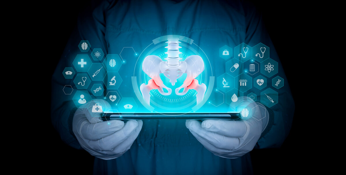 Hüftgelenk Modell | © AdobeStock_585262005