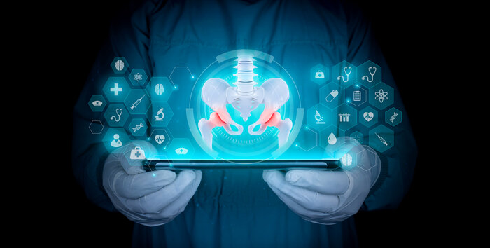 tech2much | © AdobeStock_585262005 Hüftgelenk Modell | © AdobeStock_585262005